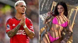 Разместен имплант и удар с глава: Прикрива ли Юнайтед насилието на Антони?