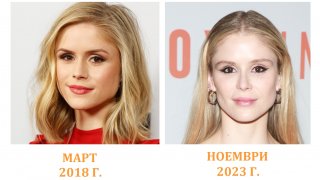 Пластична хирургия или не: На актриса от The Boys ѝ писна да коментират външния ѝ вид