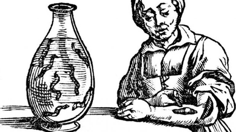 Пиявици и кръвопускане 
 Преди няколко века бръснарите, особено в Англия и Франция, са изпълнявали основна социална функция. Освен подстригване и бръснене, те са лекували и състояния от гниещ зъб, до хрема и счупени крайници. Тези бръснари са използвали специална процедура, известна като кръвопускане, целта на която била да изтече „лошата кръв“.
 От древни времена пускането на кръв е имало ритуално значение – смятало се е, че освобождава тялото от зли духове. С течение на времето тази процедура е запазила популярността си, но сменяйки предназначението на лечебните й функции. 
 В края на 18-ти и началото на 19-ти век, във Викторианска Англия пиявиците се налагат като лек за различни състояния – запушени и разширени вени, гангрени, кожни инфекции и други, а днес се използват за лечение на натравяне с желязо и прочистване при определени кожни болести.