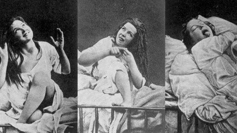 Вибратори за лечение на женска истерия 
 
Имало е времена, в които всички са смятали, че жените не могат да получат оргазъм. И са спрели да се опитват.
 
Странно защо, но тогава се появила нова диагноза, под която попадали огромна част от жените – психиатрично разтройство, което било наречено „женска истерия“. След доста изследвания било установено, че най-добрият лек за това било специална физическа процедура, извършвана от медицинско лице, която била наричана „хистеричен пароксизъм“.
 С днешни думи – получаване на оргазъм.
 В края на 19-ти век е било установено, че 75 % от американските жени страдат от истерия. „Лечението“ имало такъв успех, че лекарите изобретили специален уред, който да замести извършването на процедурата с ръце – първообразът на днешния вибратор. Първият електрически вибратор бил изобретен още преди прахосмукачката. Нововъведението намалило времетраенето на процедурата – от близо час до десет минути, а в началото на 20-ти век тази медицинска процедура станала ненужна, след като вибраторите били пуснати свободно в продажба.