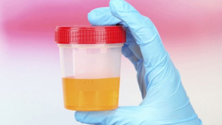 Уринотерапия 
Днес урината е сред основните „източници“ за питейна и битова вода на обитателите на Международната космическа станция. Това става посредством специална система, филтрираща течността.
Имало е времена обаче, в които се е смятало, че една от основните съставки на урината – уреата, съдържа специални антибактериални и антигъбични свойства. Въпреки тези си свойства, няма абсолютно никакви доказателства, че пиенето на урина има благотворен ефект върху здравето. 
Дълго време урината се е възприемала от лекарите като средство за третиране на състояния от акне и астма до мигрена и дори рак. Все още има доста хора, които смятат, че пиенето й избелва зъбите.
 Изследвания доказват с категоричност, че дори да не е опасна употребата в малки количества, то пиенето на урина по никакъв начин няма да спомогне за лечението на каквото и да било (дори и ужилване от медуза).