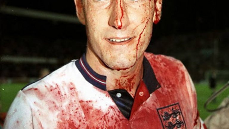 Кървавият Бъчър.
Тери Бъчър напуска терена в Стокхолм след европейската квалификация Швеция - Англия. Окървавен, с огромна рана на челото, Бъчър отказа да бъде сменен и остана в защитата на тима си, на който бе и капитан. Англия стигна до реми, което я класира.