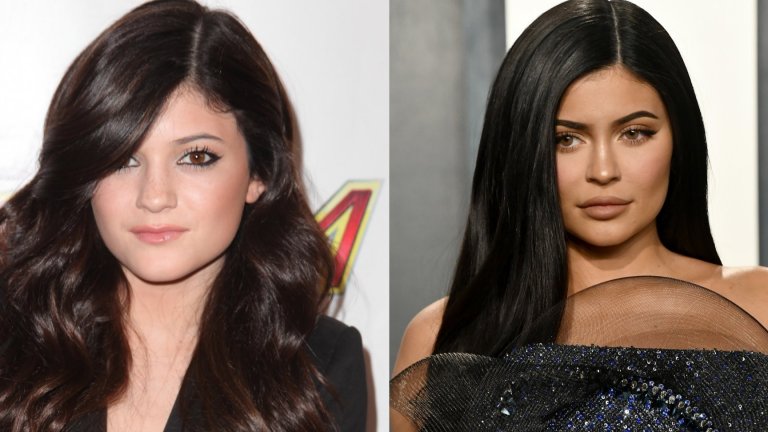 Кайли Дженър 
Фамилия Кардашиян-Дженър обожават трансформациите и това да променят външния си вид. Косите им преминават през всички цветове на дъгата, включително синьо и лилаво, а пластичните интервенции за тях са нещо напълно обичайно. И въпреки това Кайли е тази, която действително се преобрази напълно пред очите ни. 
Няма какво да се лъжем, при нея огромна част от измененията се дължат на чудесата на козметичната индустрия и пластичната хирургия, но е факт, че Дженър няма нищо общо с облика си от миналото. Устните ѝ са видимо уголемени, носът ѝ е с по-фина форма, а от излъчването на невинно момиче няма и помен.