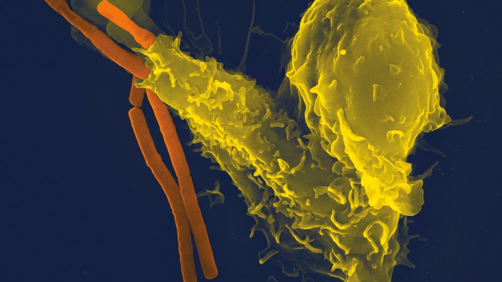 Neutrophil_with_anthrax_copy