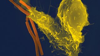 Neutrophil_with_anthrax_copy