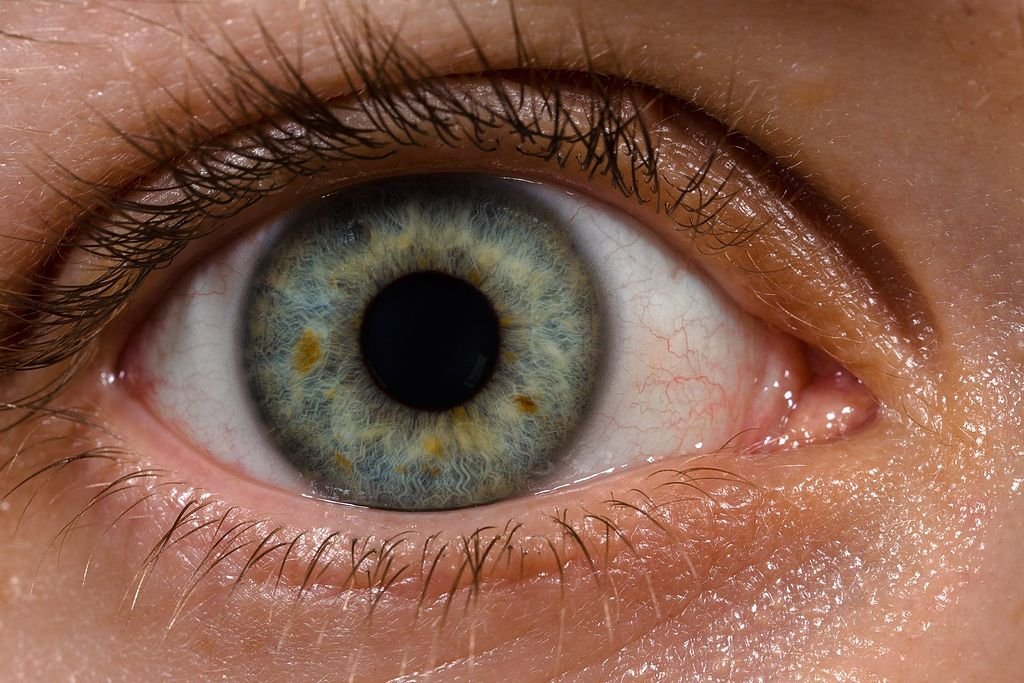 1024px-Human_eye_with_blood_vessels