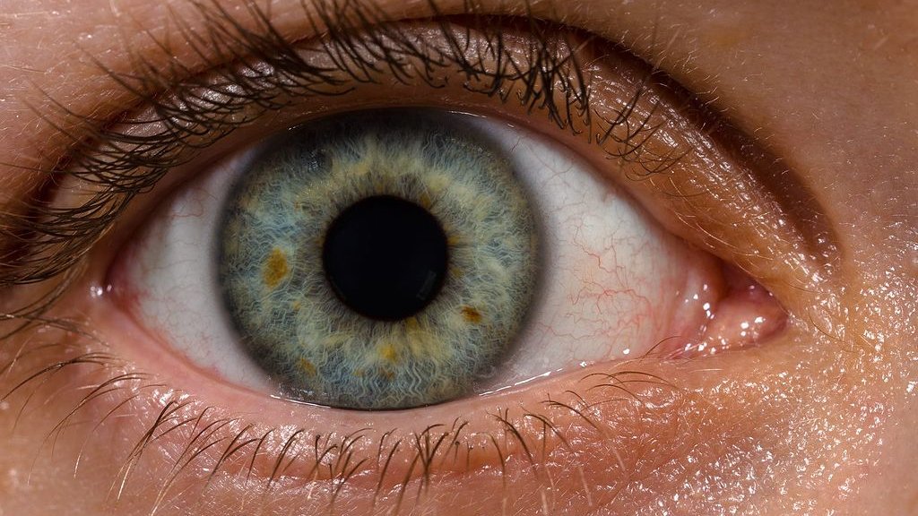1024px-Human_eye_with_blood_vessels