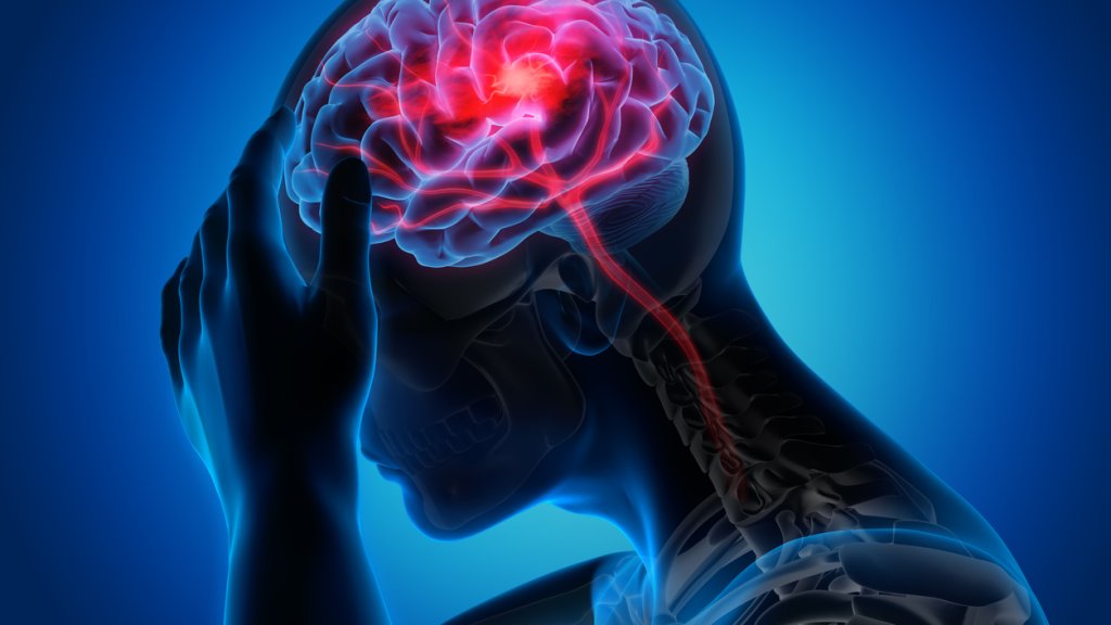 Man with brain stroke symptoms