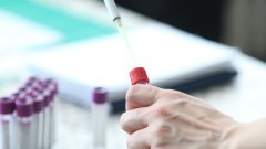81 нови случаи на коронавирус и 67 излекувани